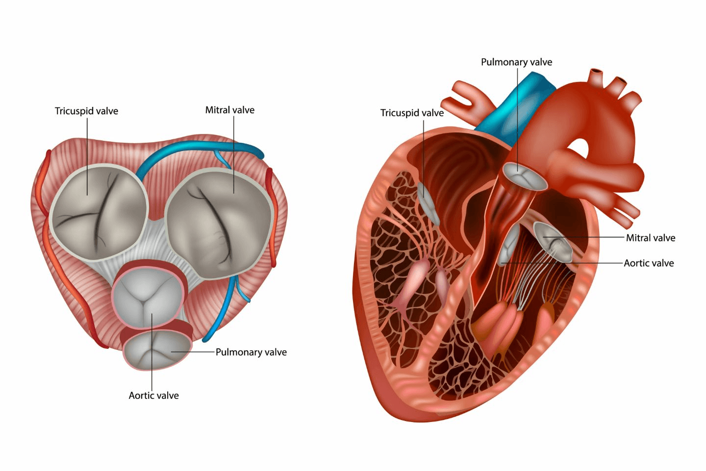 Difference between Aortic Stenosis and Aortic Regurgitation
